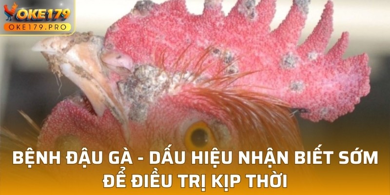 Bệnh Đậu Gà